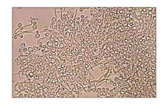 Дрожжевые грибы в кале. Микроскопия грибов кандида в Кале. Дрожжеподобные грибы в Кале Candida. Дрожжи в Кале микроскопия. Нити мицелия в моче микроскопия.
