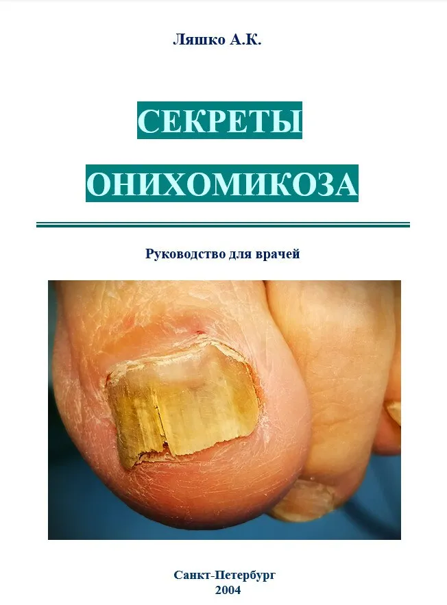 Обложка: Секреты онихомикоза