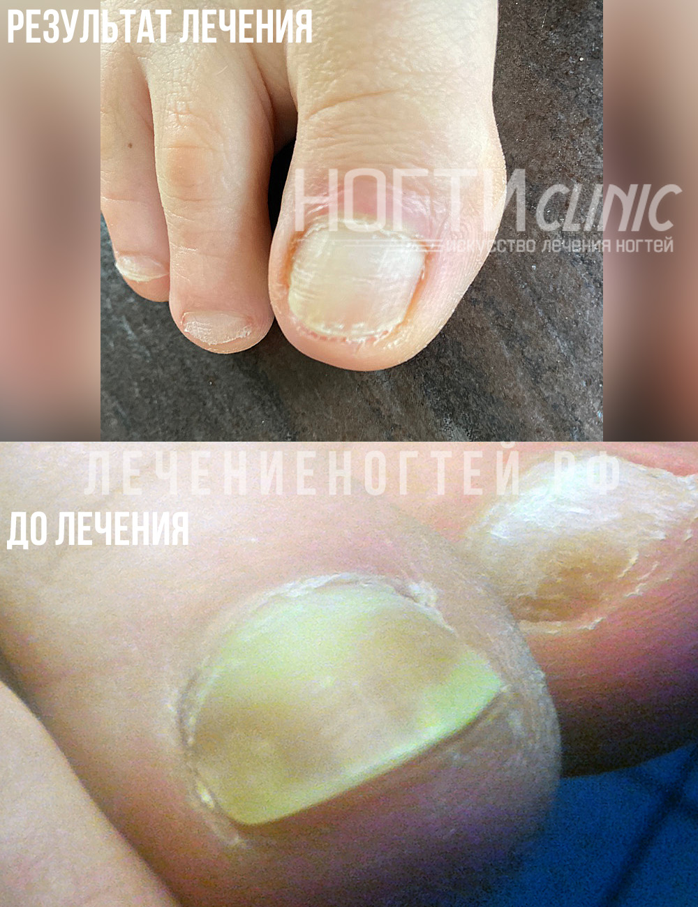 Ляшко А А отзывы ногти клиник