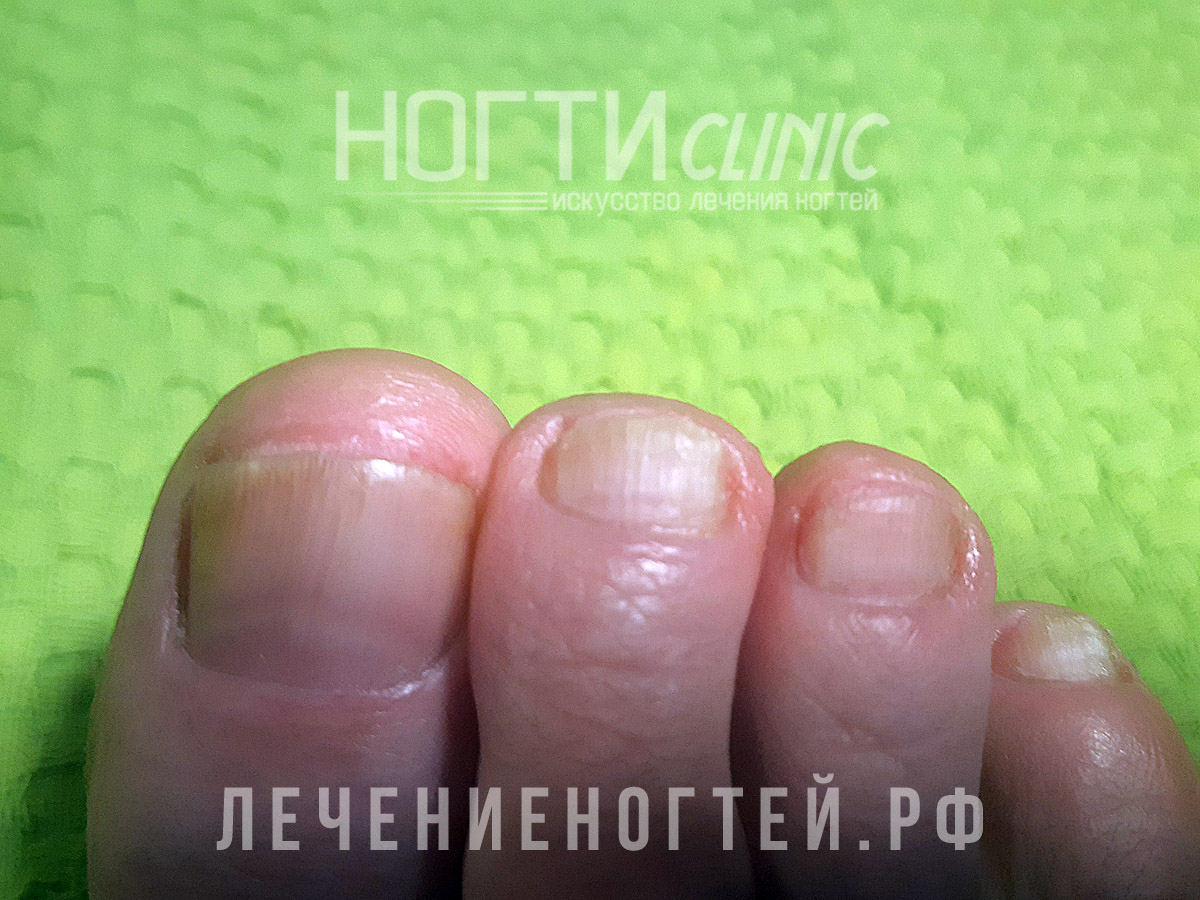 Отзывы Ляшко А К Ногти Клиник