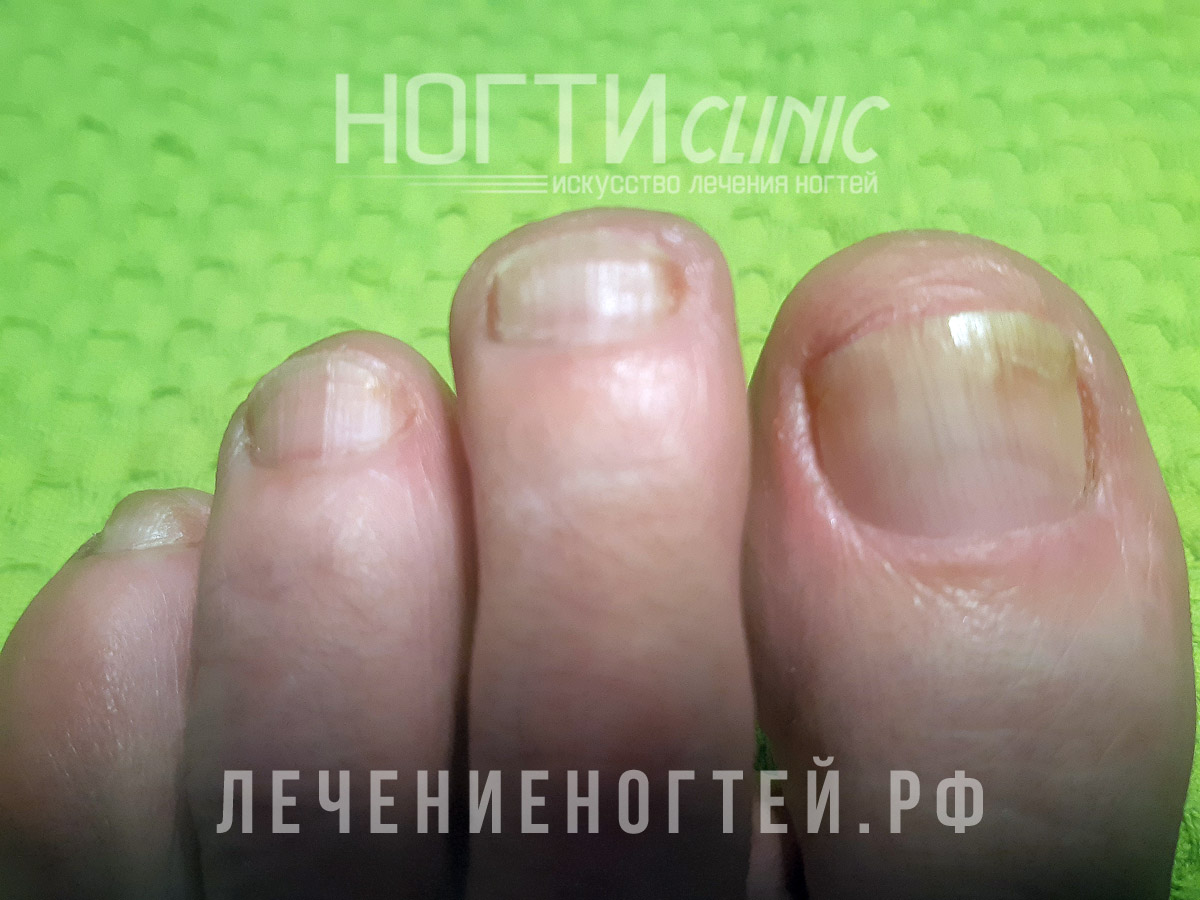 Отзывы Ляшко А К Ногти Клиник