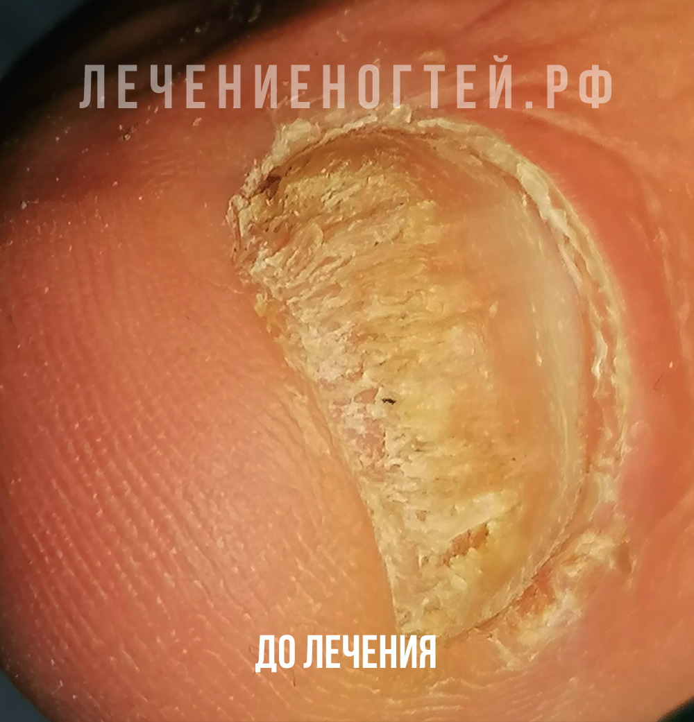 Отзывы Ляшко А К Ногти Клиник