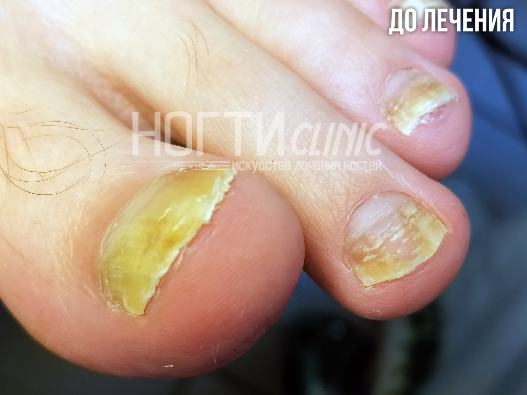 Отзывы Ляшко А К Ногти Клиник