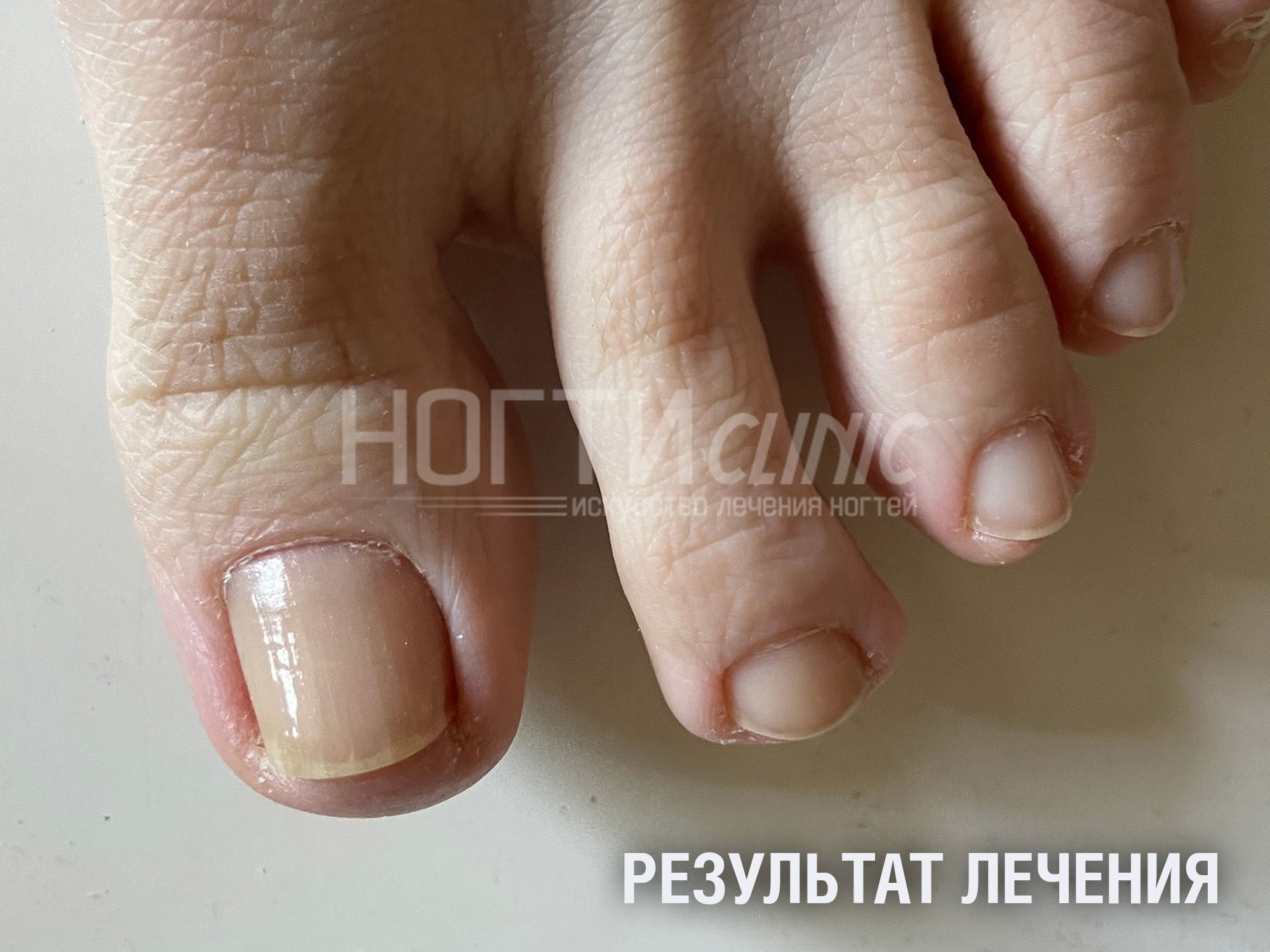 Отзывы Ляшко А К Ногти Клиник
